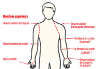 Niveaux d'amputation du membre supérieur