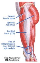 Fascia lata