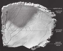 Vue endocranienne de l'os pariétal