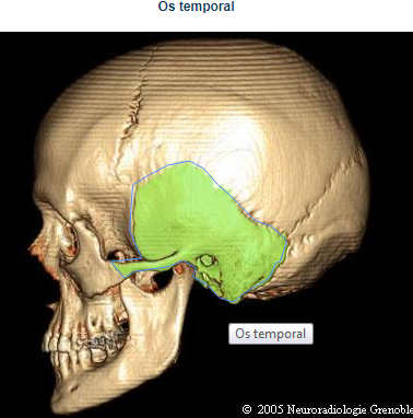 Os de la face